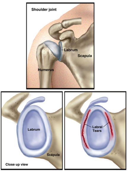 Shoulder Joint