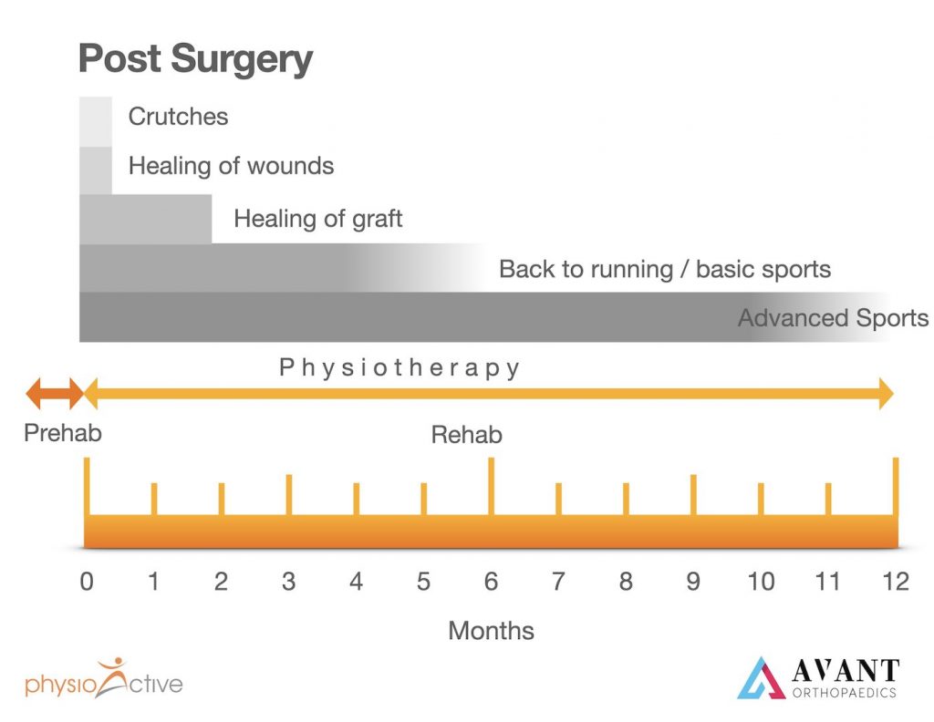 ACL Reconstruction Recovery Timeline