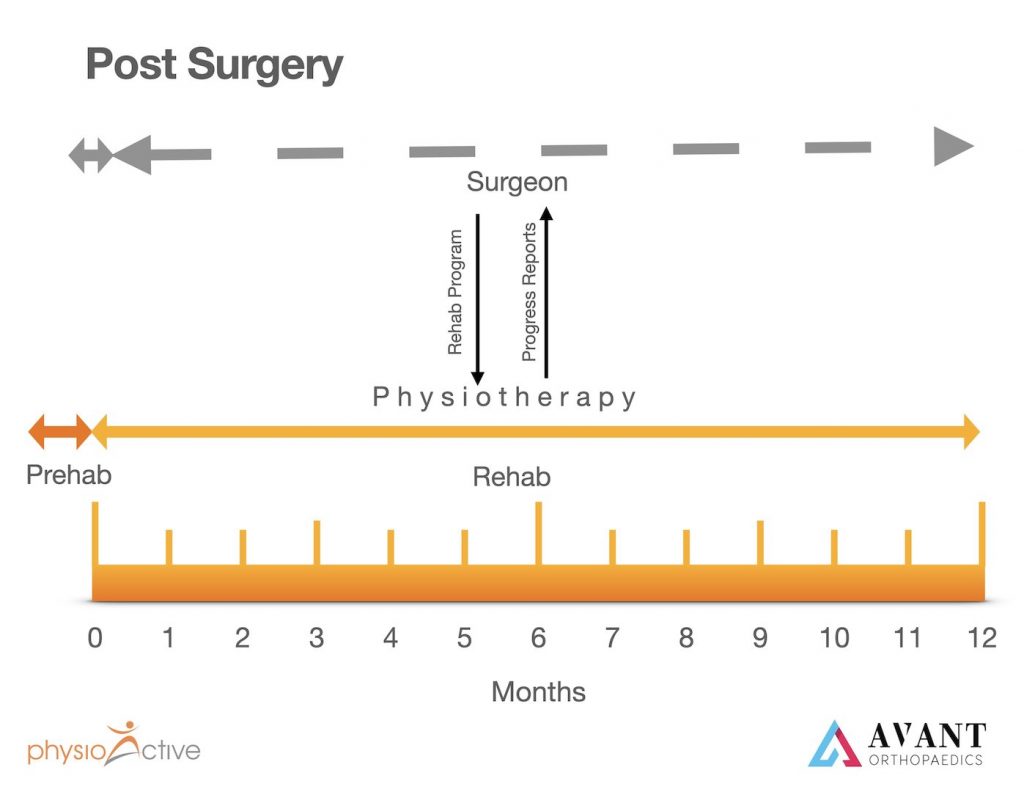 ACL Reconstruction Interaction Physio Surgeon