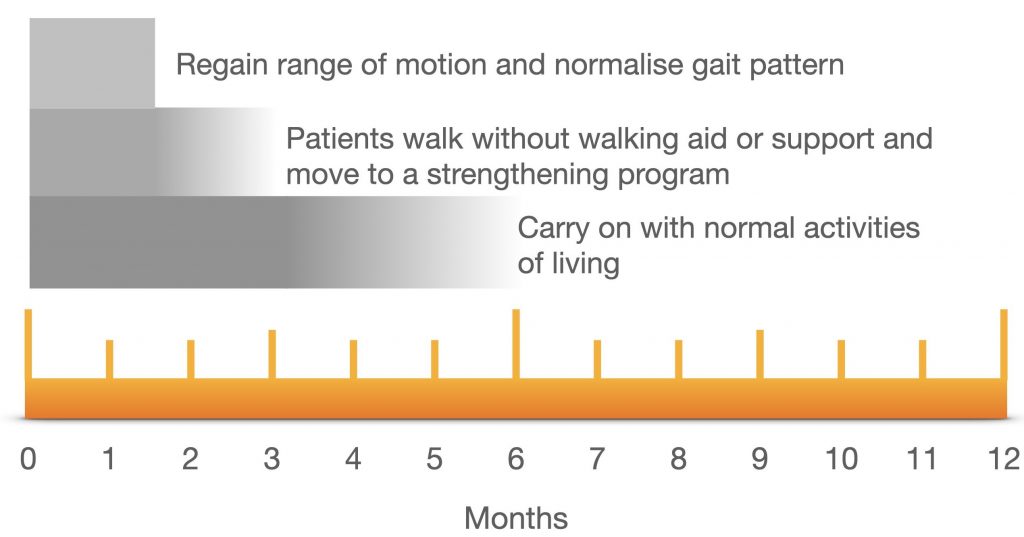 Robotic Knee Replacement Timeline