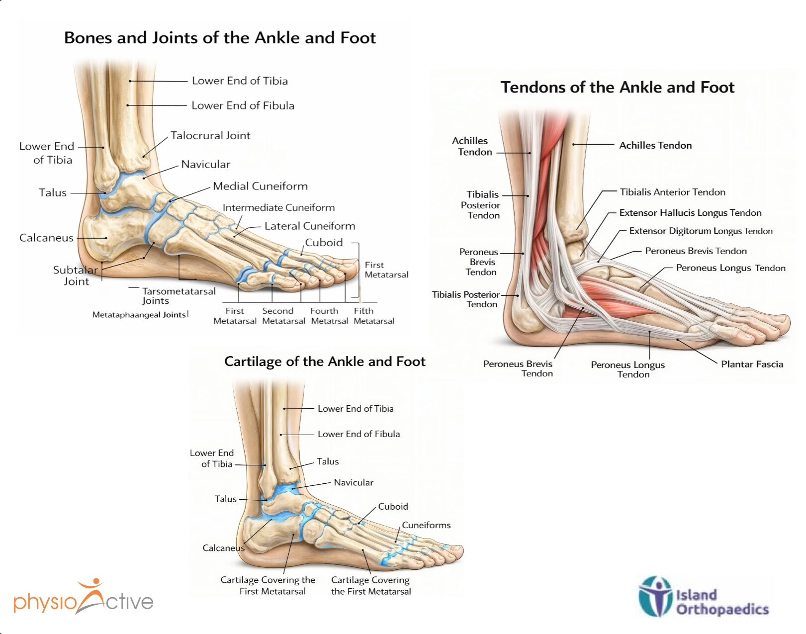 Anatomy of the ankle and foot showing bones, joints, tendons and cartilage — including Achilles tendon, peroneus tendons and plantar fascia